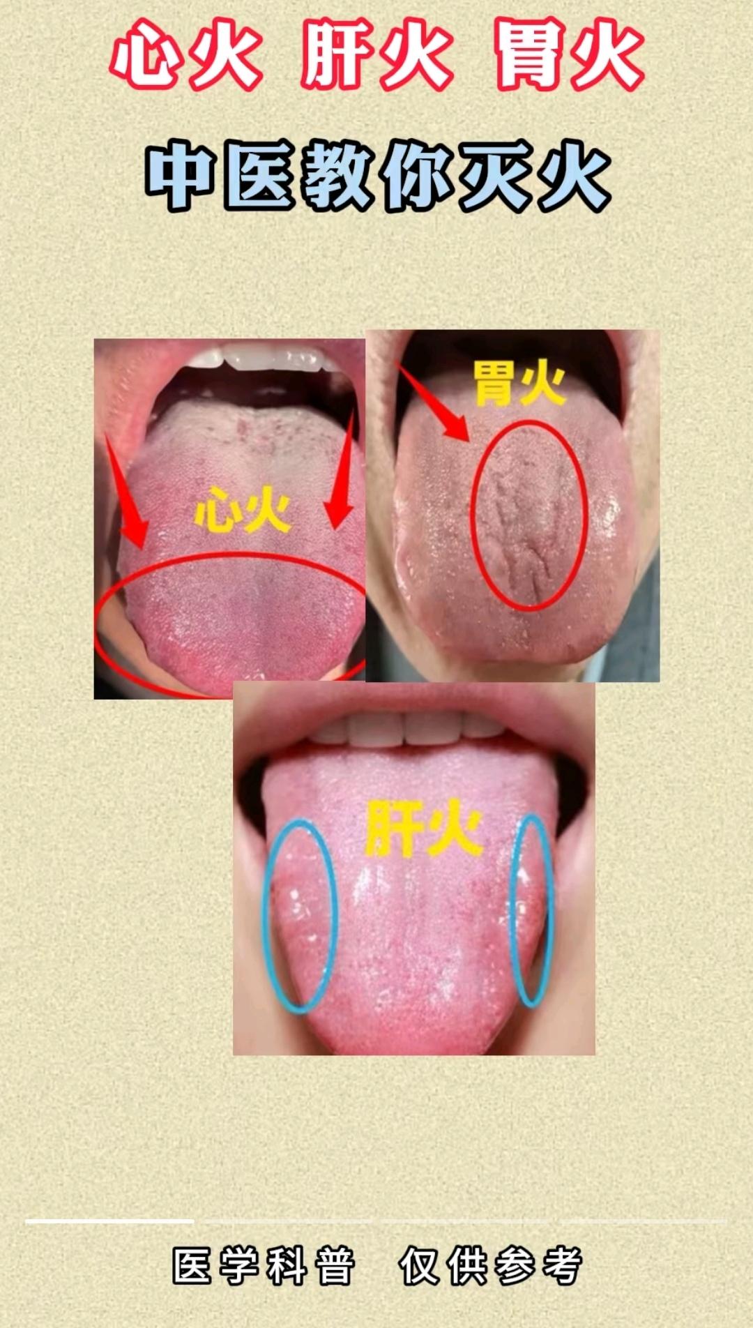 养生就是养健康 健康科普 舌苔辨证