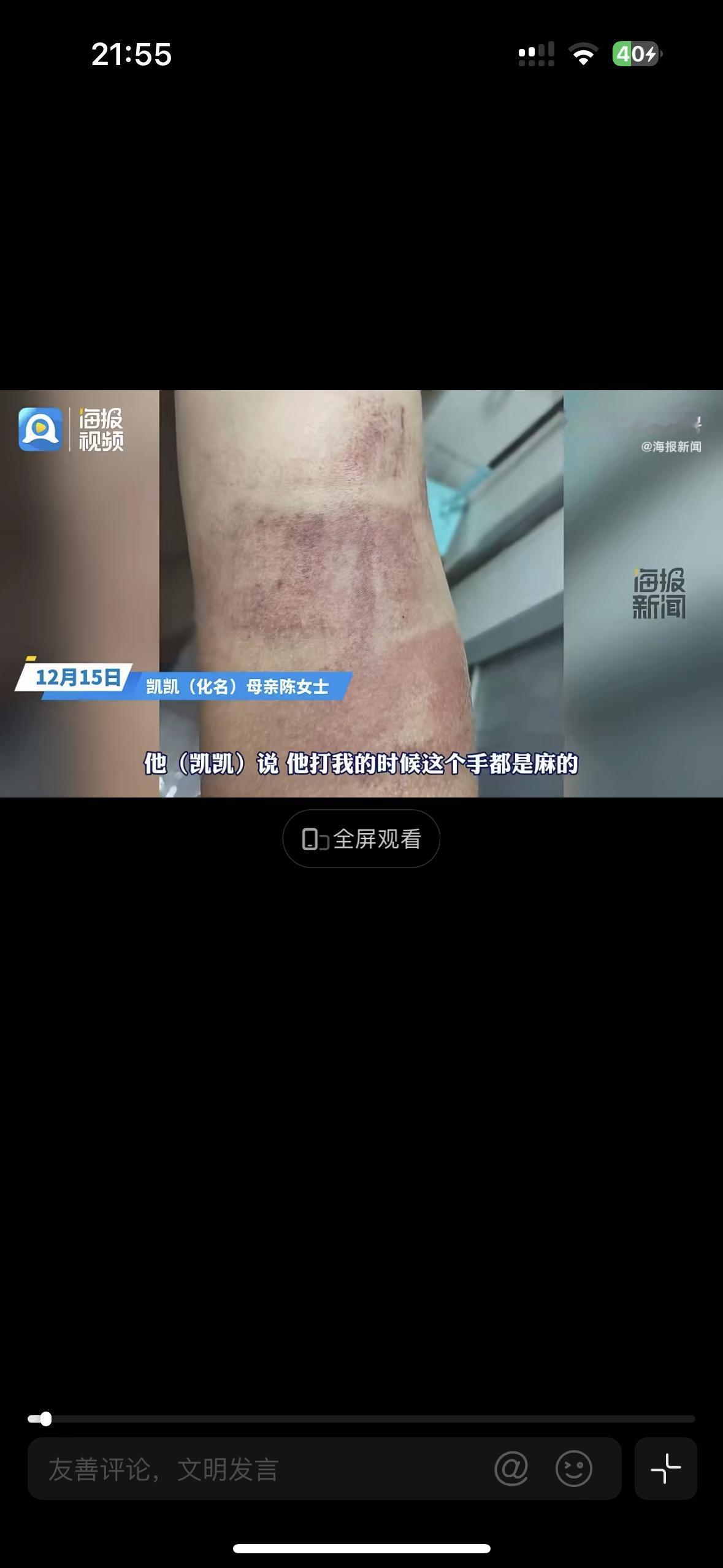 太吓人了！简直触目惊心，4年级的男生因为国庆期间丢了2份试卷，被老师拿着戒尺打。