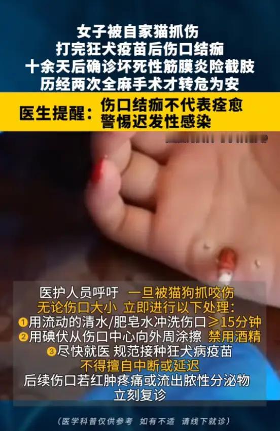 “悲剧还是发生了！”8月12日，陕西西安，一姑娘被自家猫抓了脚，打完狂犬疫苗见结
