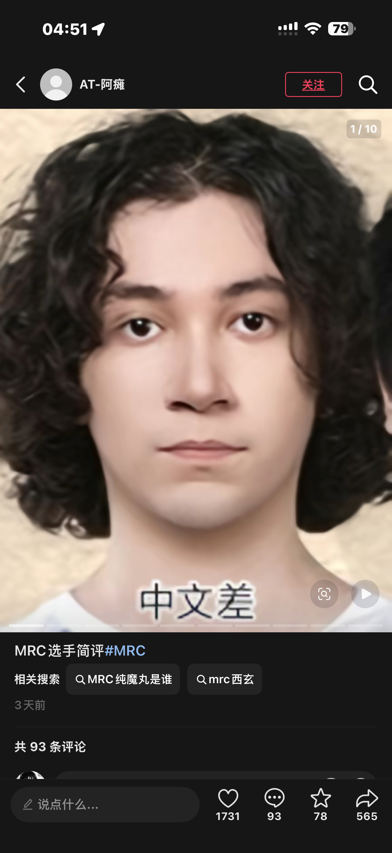 我他妈抽搐在 