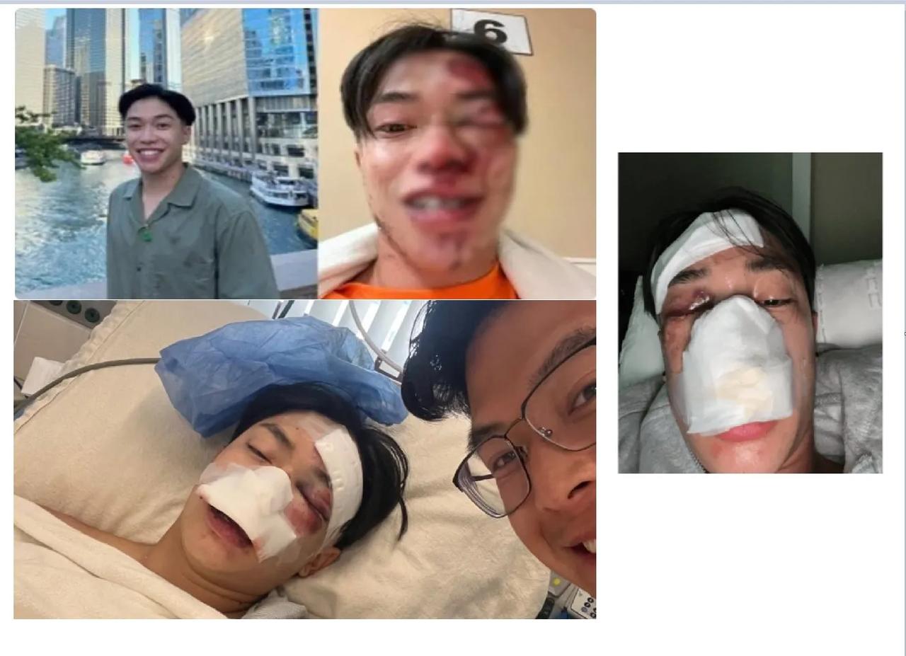 美国亚裔青年布兰登被打成了“筛子”，他没有做错什么，被打的原因只有一个：他们以为