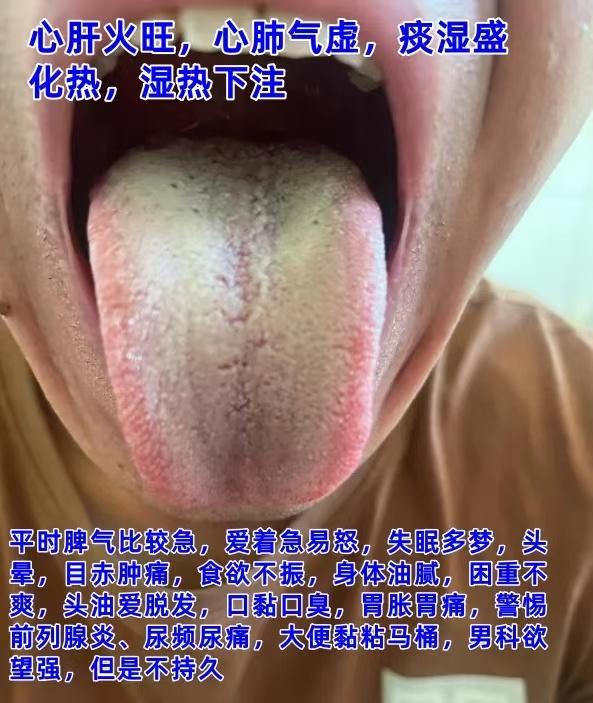 今天不忙，舌诊公益，继续来帮大家分析舌象：

如果有需要，尽管把你的舌象发过来