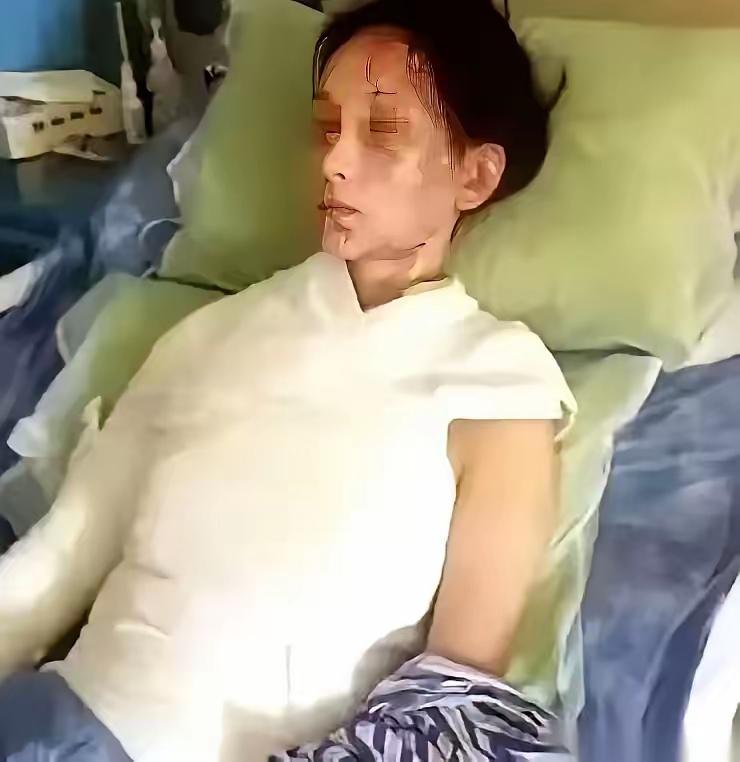 人狂必有祸，几句口角，

竟换来终身的伤痛！

人被怒火冲昏头脑的时候，根本想不