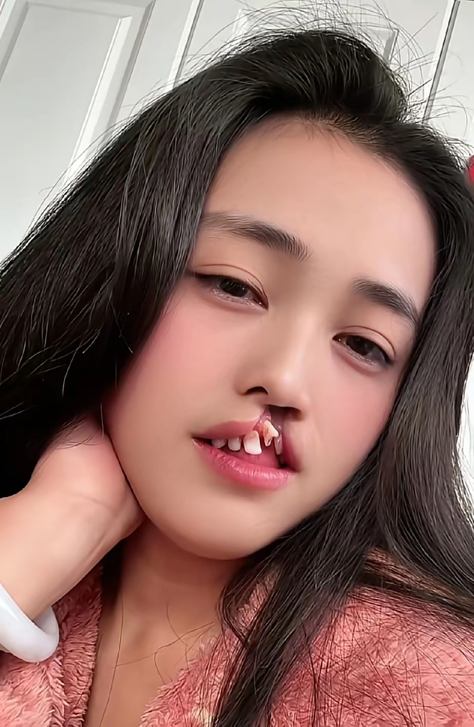 看到这个患病女孩的画面，更加感受到李亚鹏先生所做的公益事业是何等的有意义！ 