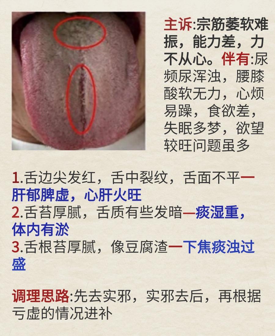 今日舌象案例分析——痰湿，肝郁脾虚，阳虚