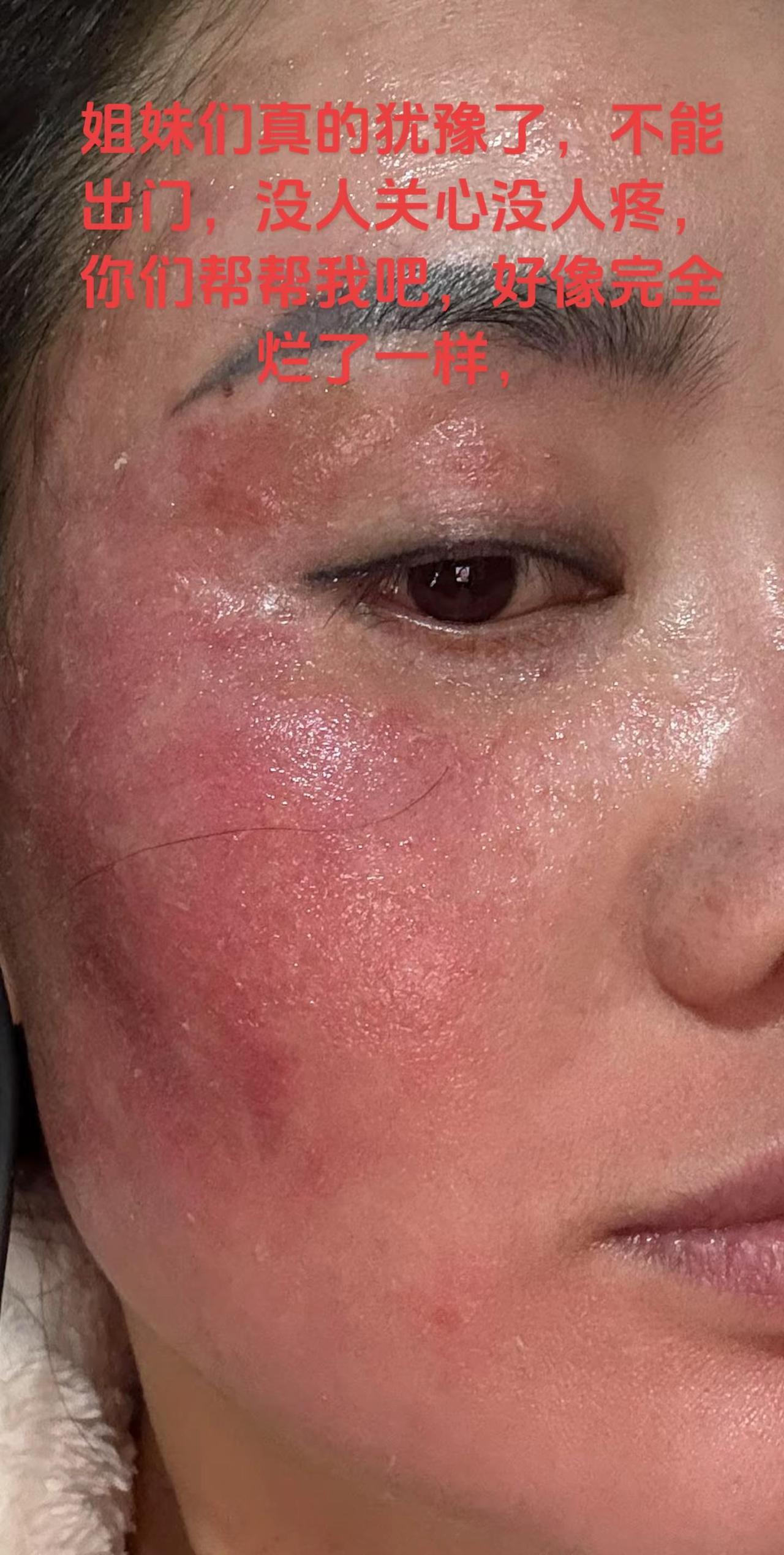 谁来救救哟，谁来帮帮我。