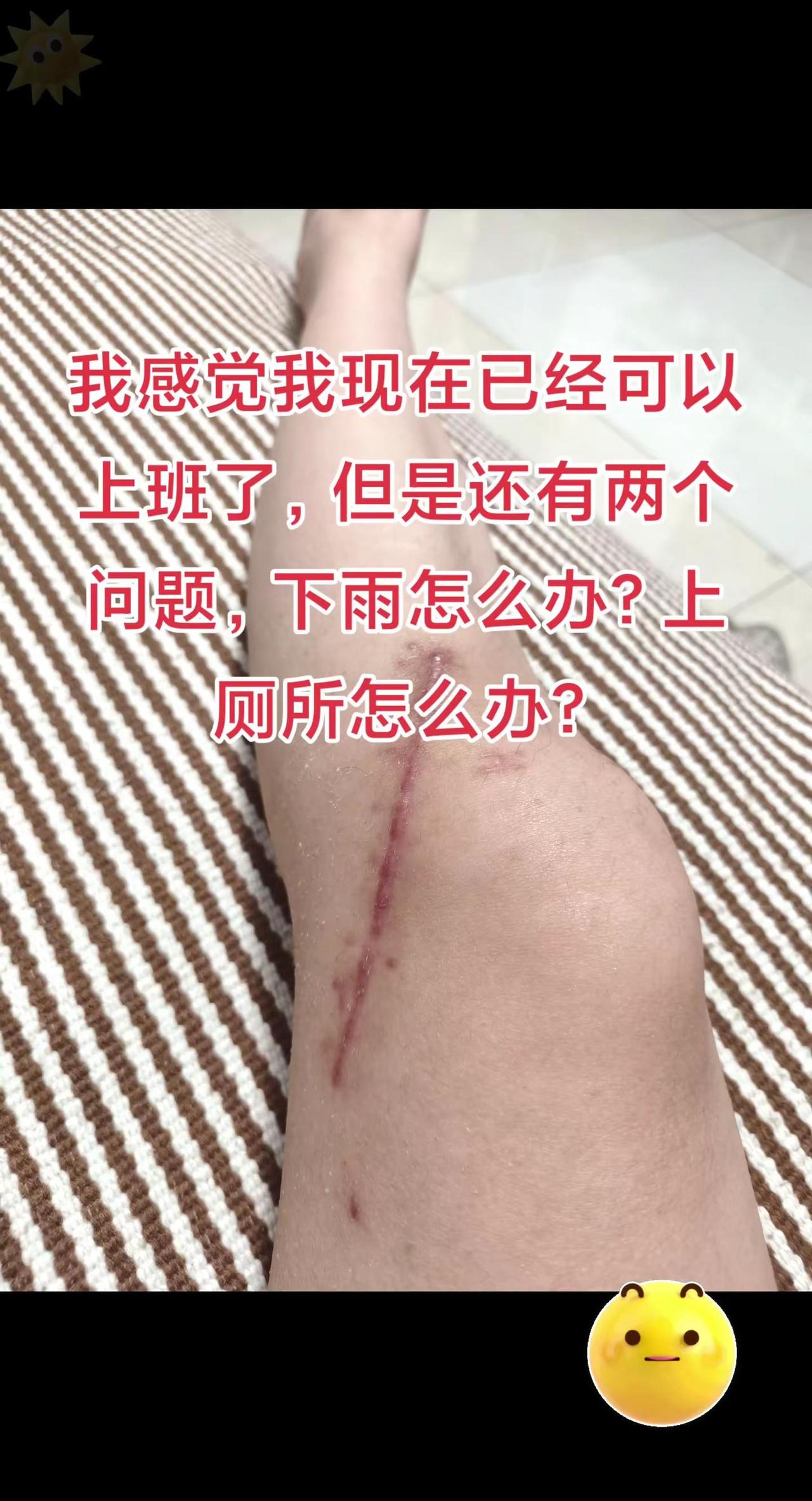 蹲不下去，看见人多就害怕，短期内克服不了怎么办？