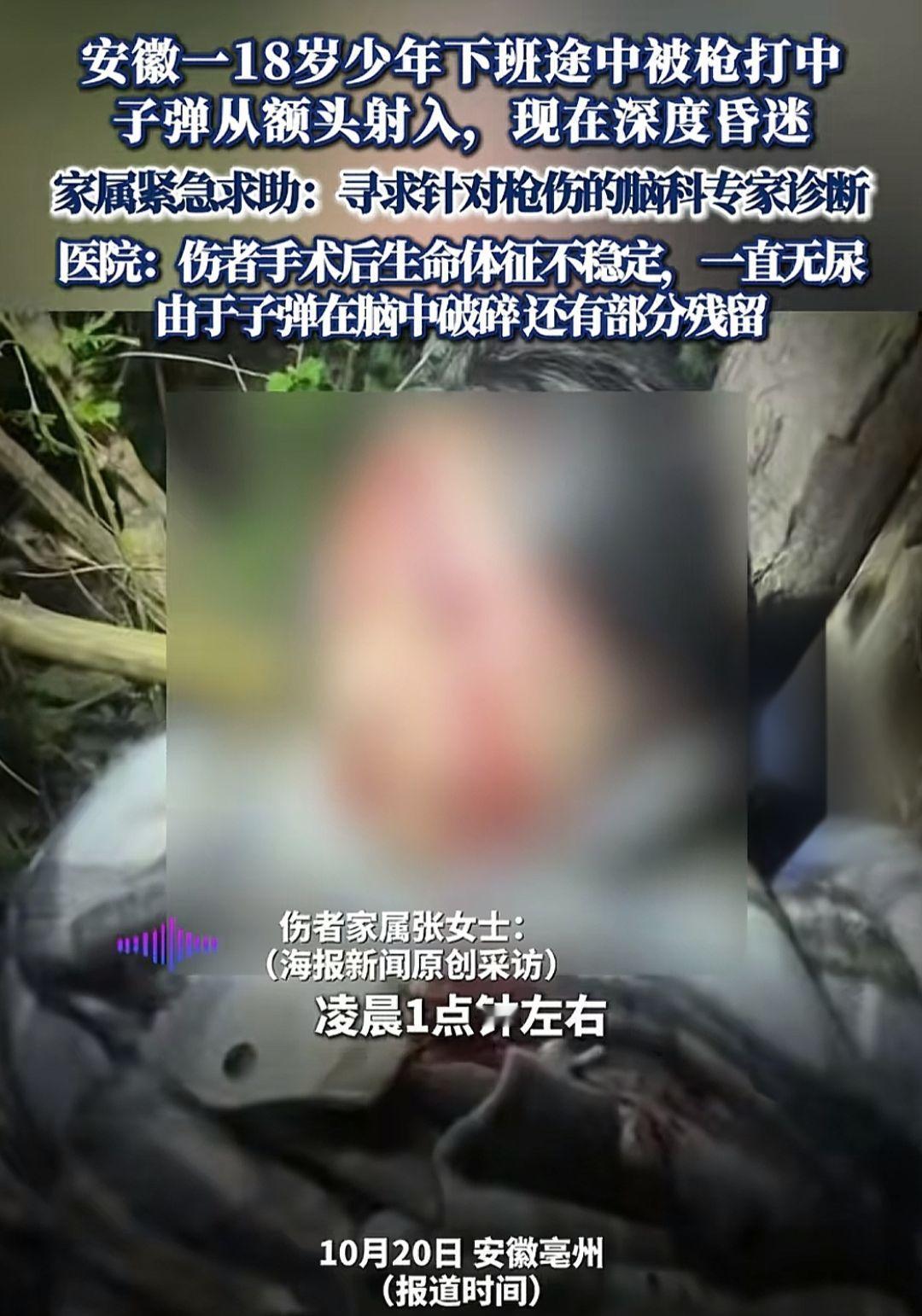 事件经过：10月20日凌晨1点左右，安徽毫州﹣18岁少年被气枪打伤头部 家属紧急