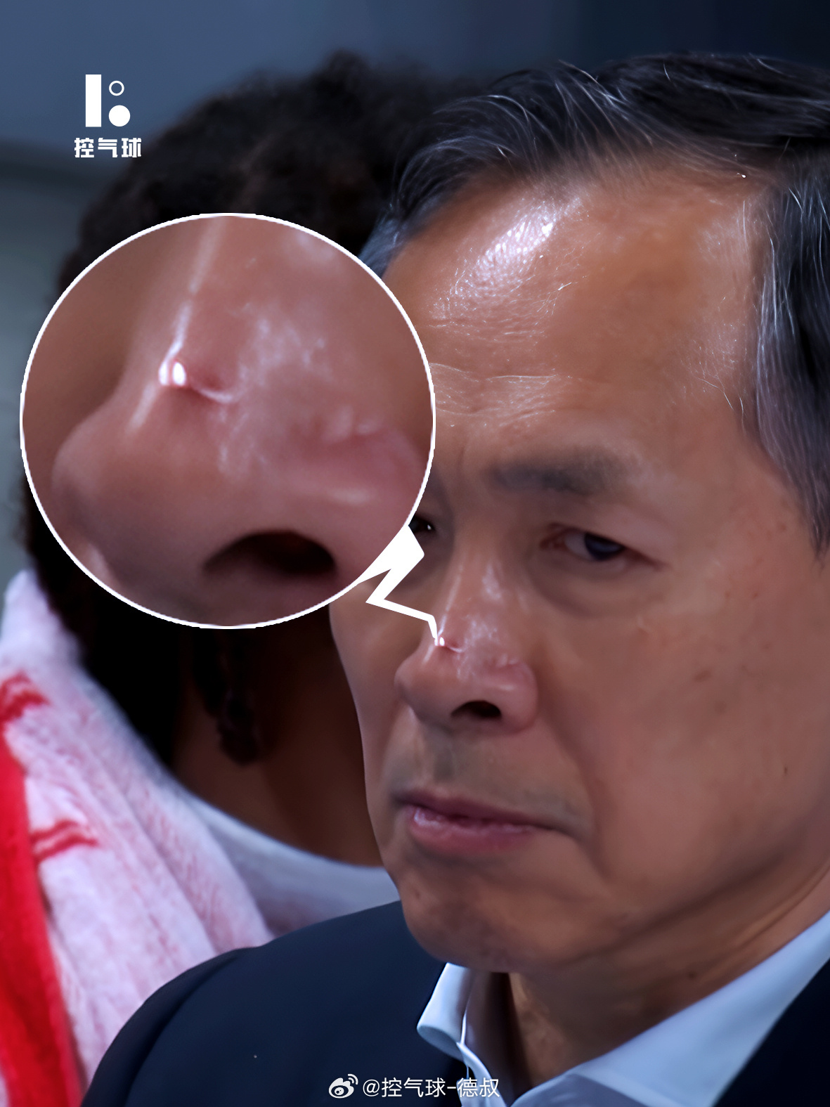 带北京男篮属实熬人！能看出许指导身心俱疲，鼻子都急出脓包。系列赛落败留下诸多遗憾