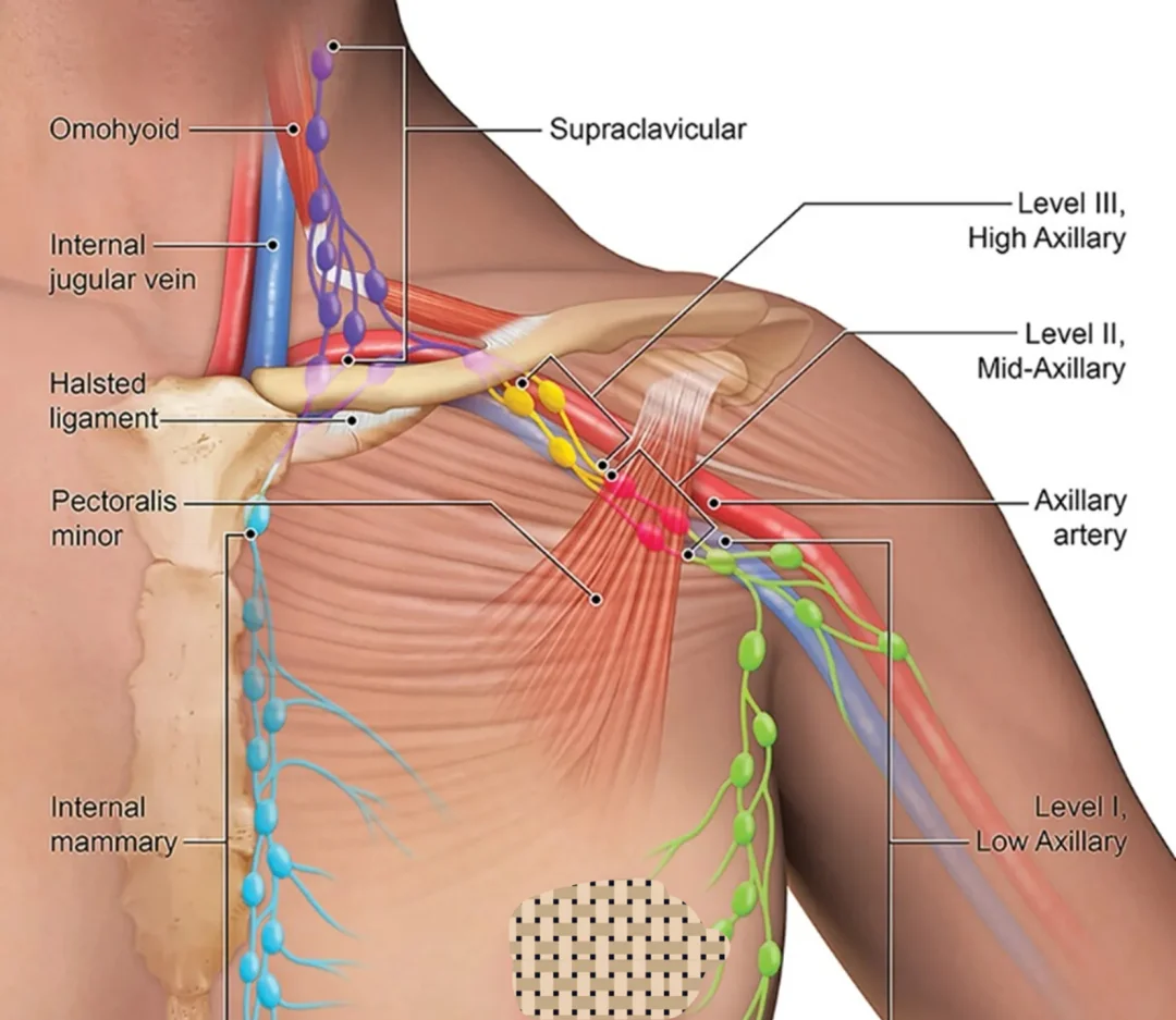 淋巴！淋巴！带你看懂乳腺癌的淋巴🫘