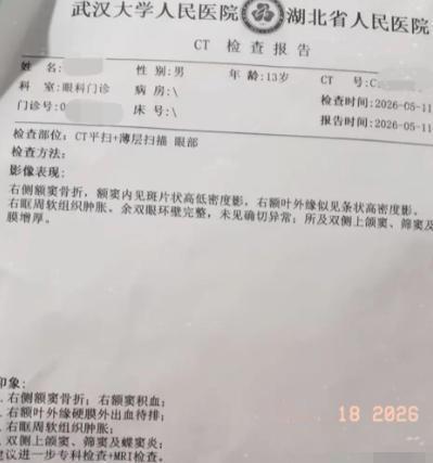 灭绝人性！花3万多把亲儿子送进"地狱"？江西一名13岁男孩只是性格有点叛逆，父母