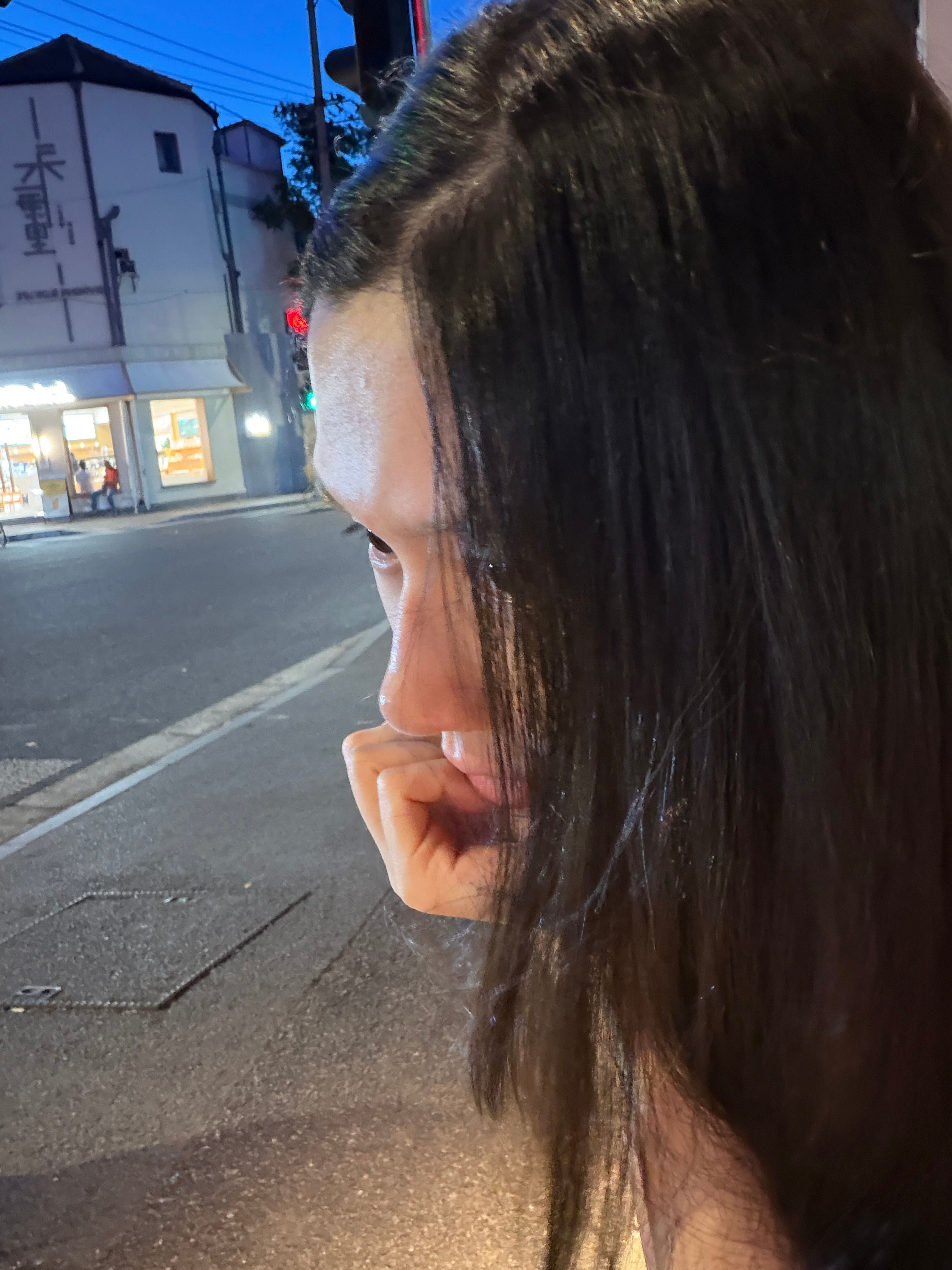 额头变化图一二三是今天图四是几个月前，但也已经打过好几次我原来的额头后倾很严重 