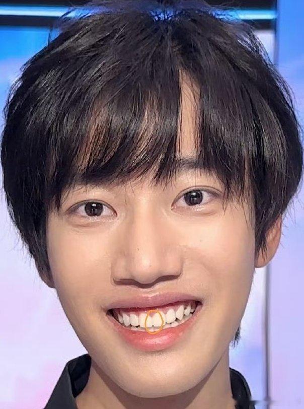 清融去补了牙缝清融去补牙缝了不声不响把牙缝修复好了，训练赛程排那么满还抽空打理，