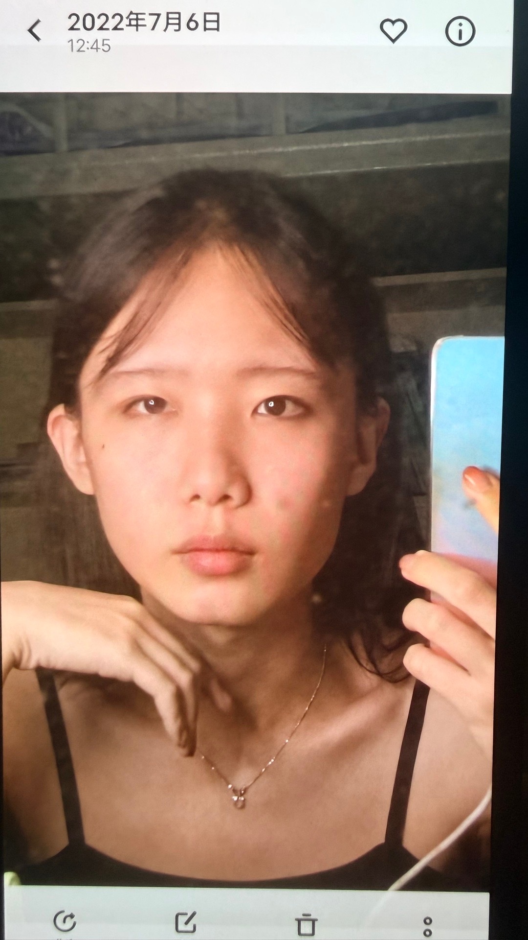 之前经常没活了就会聊整容相关话题爆爆数据，或多或少带些情绪和表演，不够走心。平心