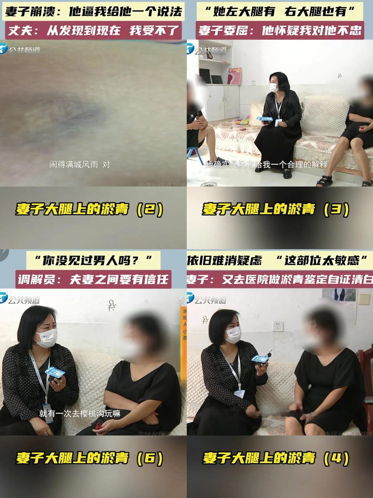 凌晨出差归来，丈夫撞见妻子大腿淤青，没问缘由就把事情捅到家族群，撂下“离婚就别想