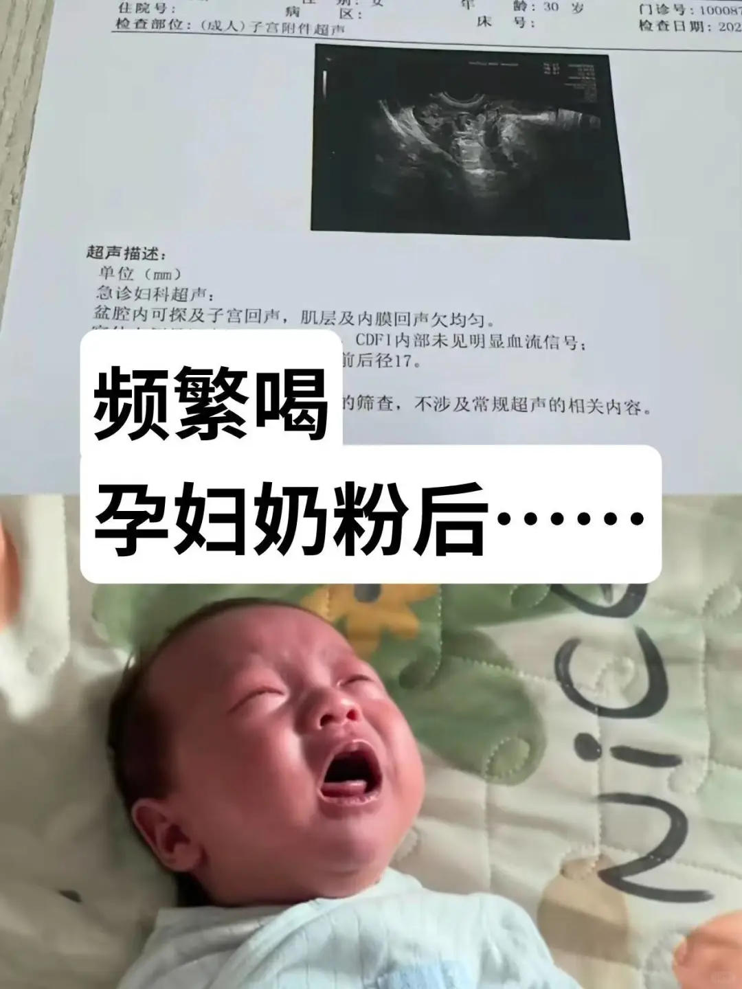 只有没脑子的人才会跟风喝孕妇奶粉