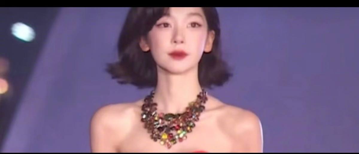 曝易梦玲肩膀打了玻尿酸易梦玲肩膀头子好多网友说易梦玲肩膀头子打了玻尿酸，所以看起