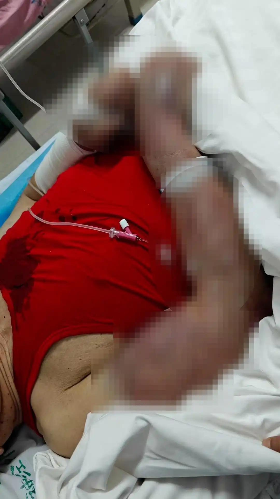 老人暴打老人！如此养老院是如何管理的？
近日，北京的马女士向记者反映，其73岁的