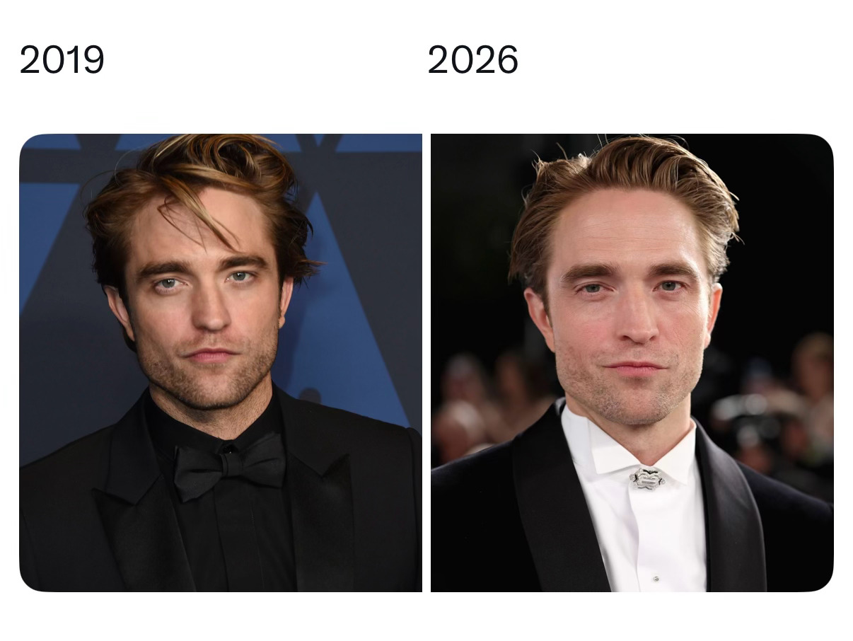 网友求支招：罗伯特帕丁森是有什么驻颜奥秘吗？ 