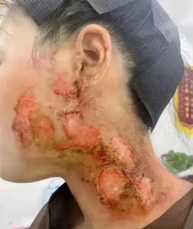 近日，河南一位大姐吃火锅时叫服务员加汤，10分钟后服务员才过来，大姐非常生气，不