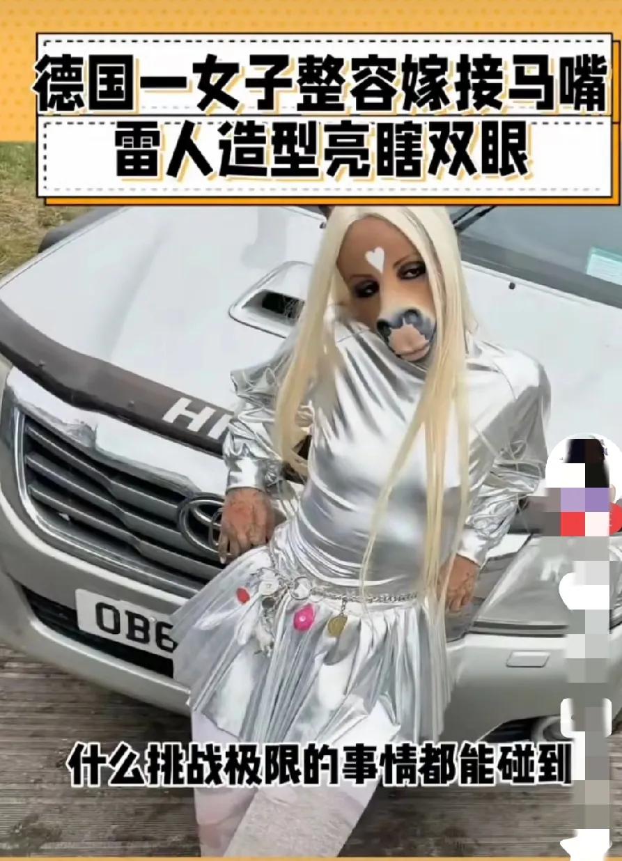 德国一女人，马面人身，不是天生的，也不是戴的面具，是整容了，嫁接的马🐴嘴，为什