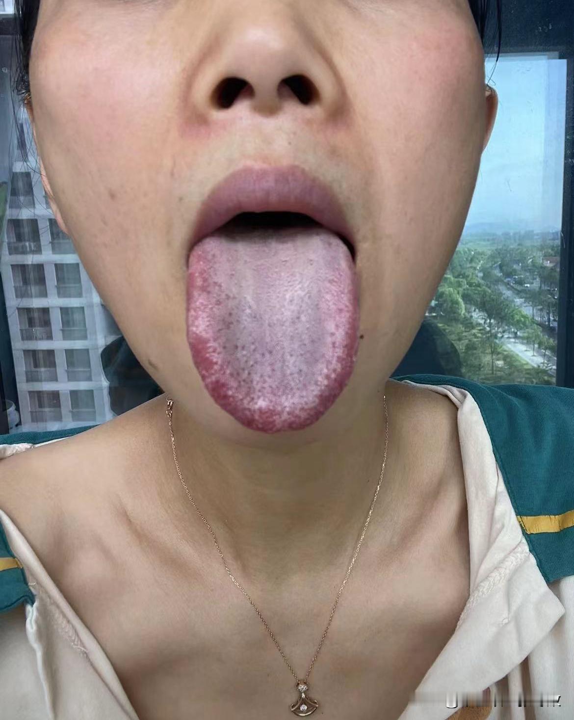 舌头乌黑发紫，连嘴唇都青紫，这舌头你咋调[what][what][what]

