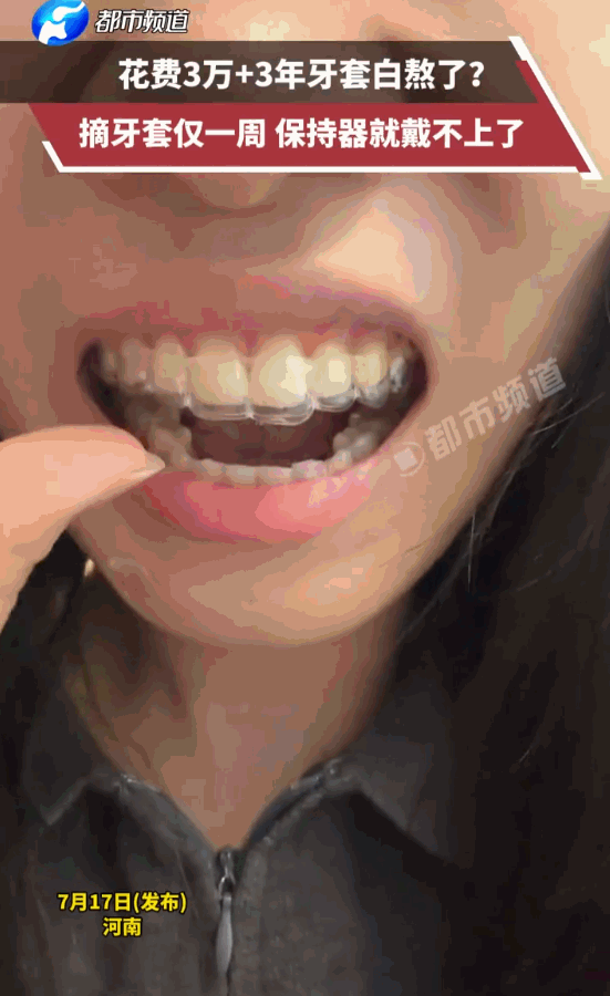 一着不慎，满盘皆输！河南，一位年轻姑娘在洗漱台前看着镜子，发现自己原本整齐的牙齿