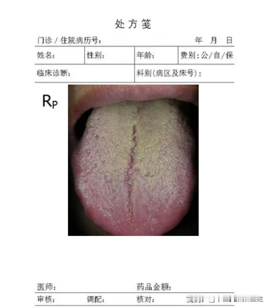 这种舌象，小毛病不少，找准顺序，调理起来也不难

患者主诉：宗筋萎软，时间快，阴