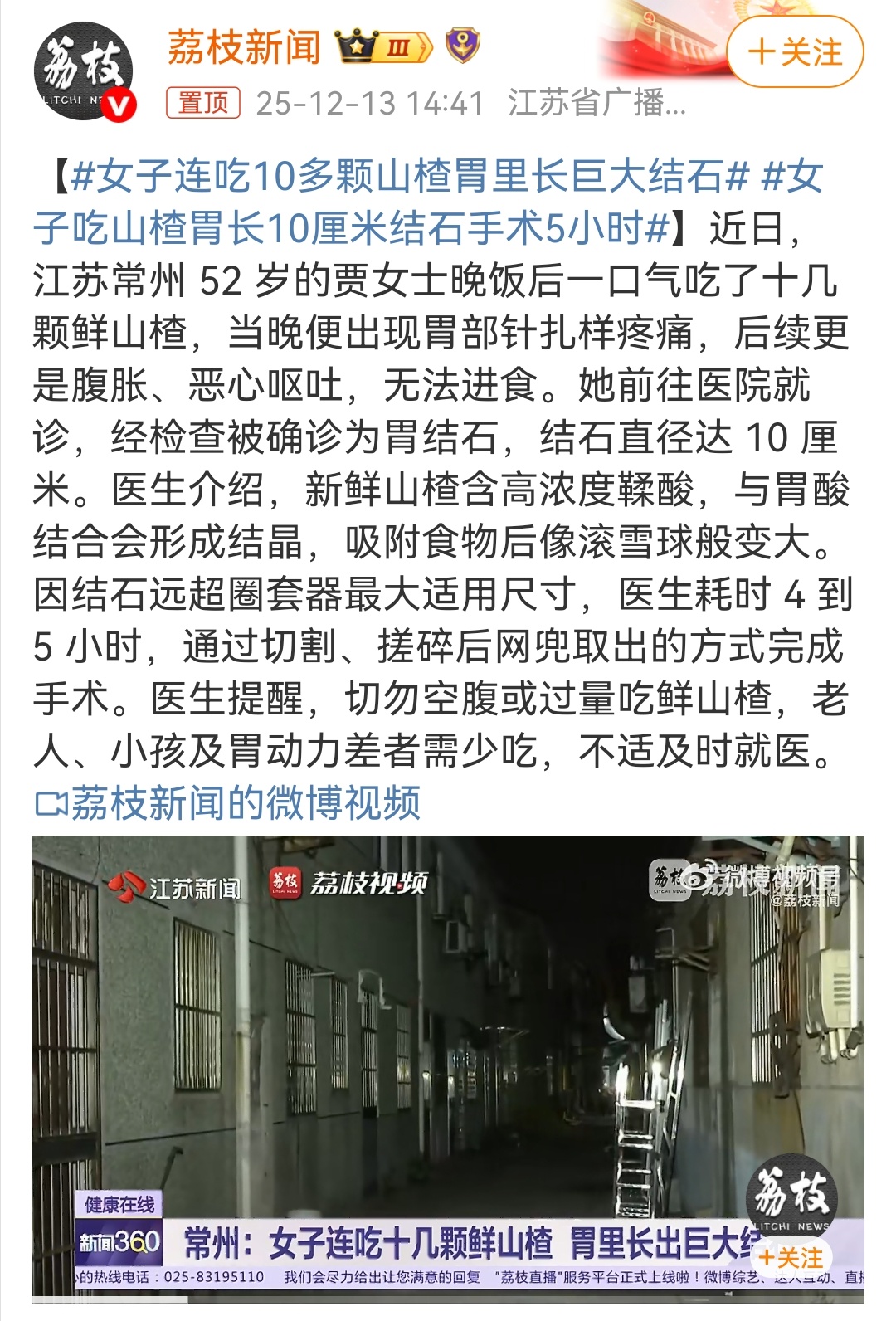 女子连吃10多颗山楂胃里长巨大结石所以山楂糖葫芦是不是也得少吃。