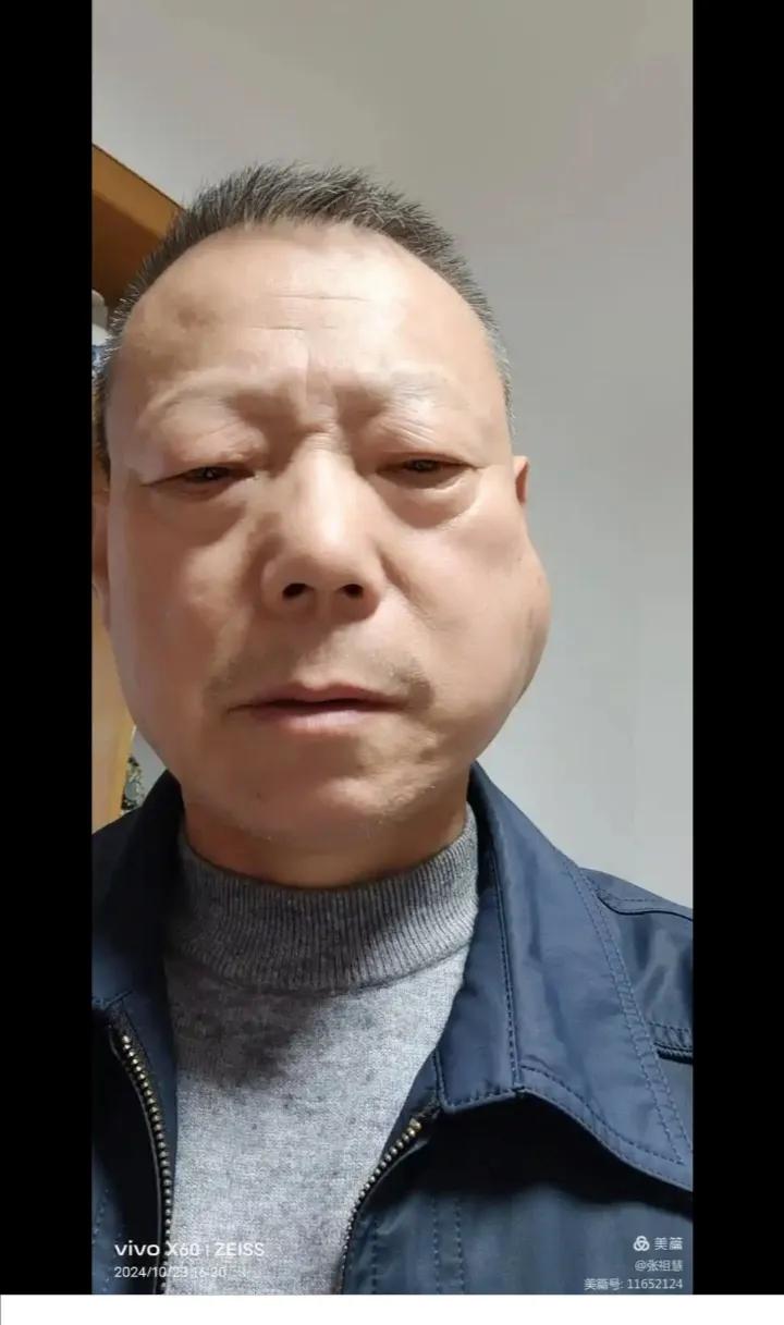 为什么我们小时候有炸腮病毒，几乎每个小朋友都得过，而现在的几乎听不到这个病毒了？