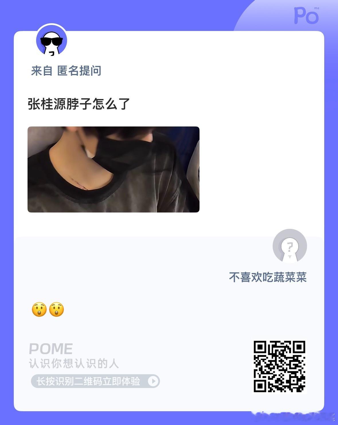这是怎么了？ ​​​