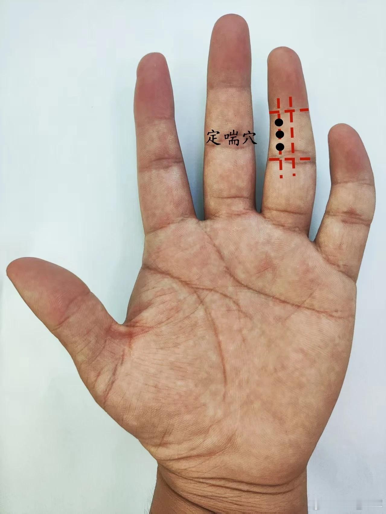 咳喘，定喘穴 定喘穴源自董氏奇穴位置：在手掌面，无名指第二节中央线偏大拇指侧三分