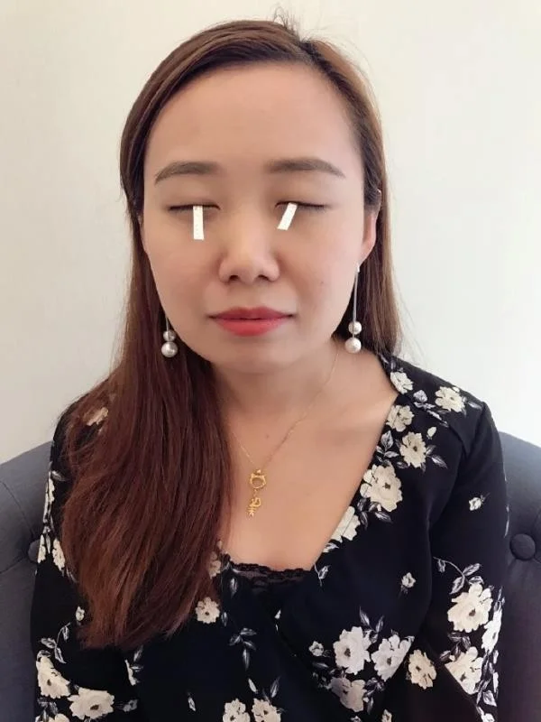 教大家看懂干眼检查报告单
