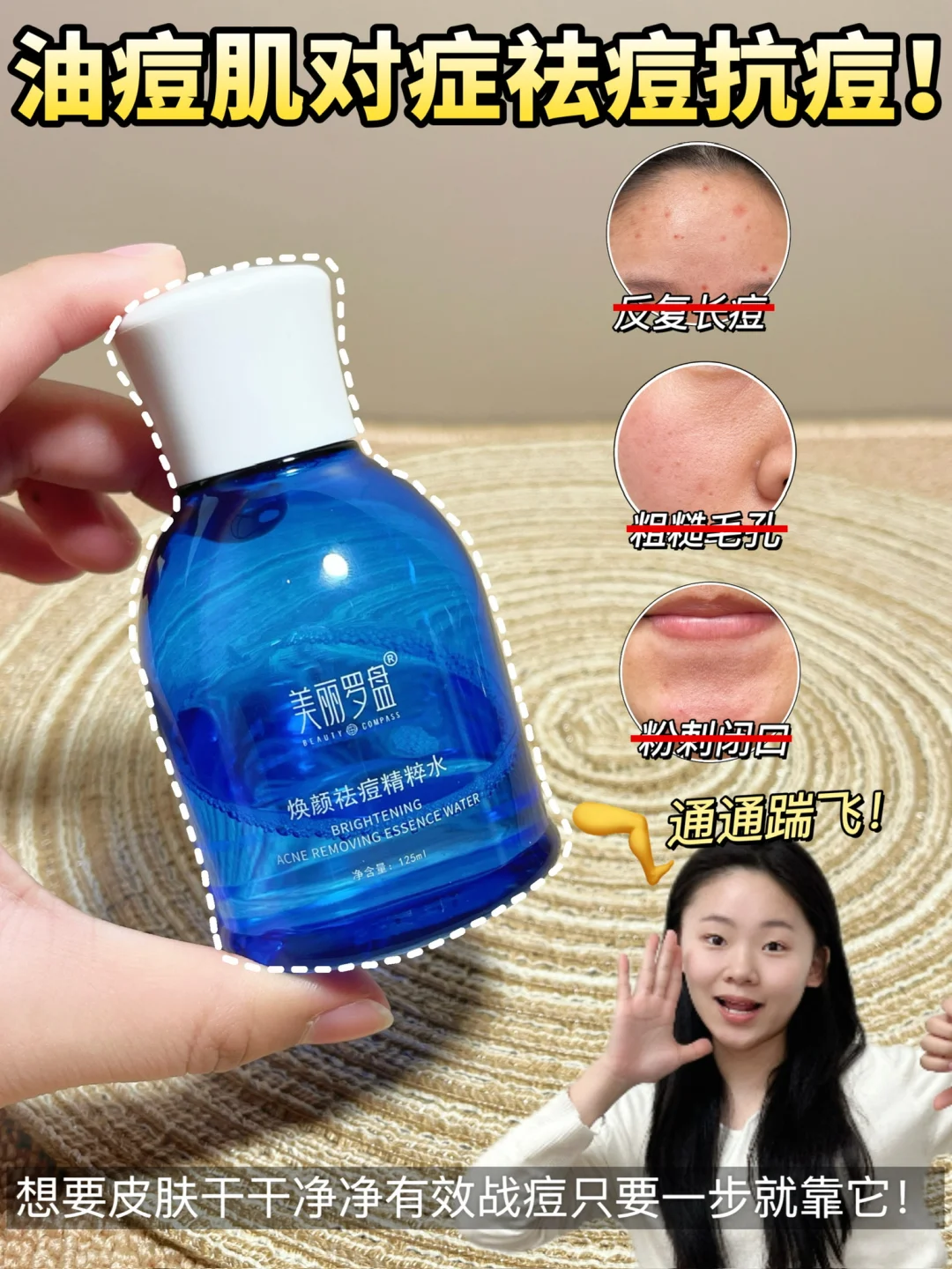 我嘞个大痘！终于不用吃油痘肌的苦了！