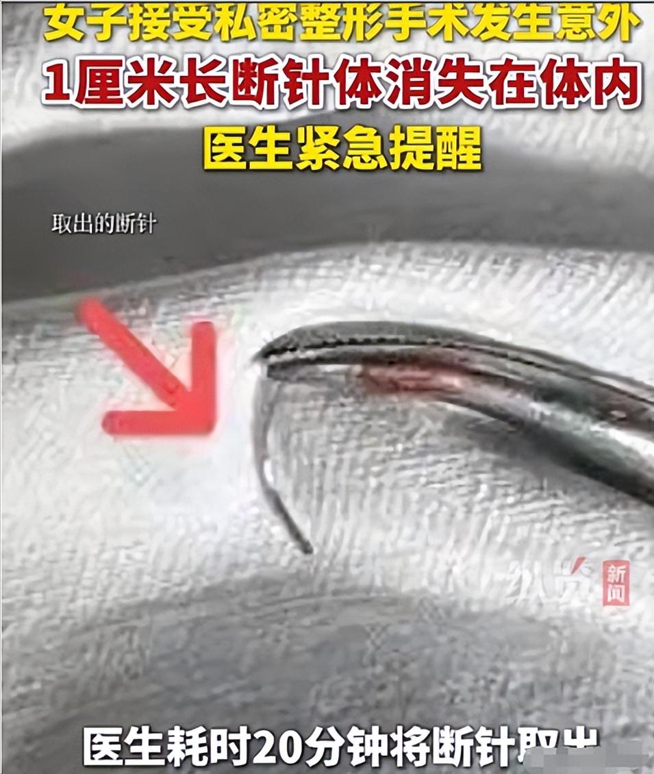 “替她捏了一把汗！”浙江，一女子生完孩子后，担心被丈夫嫌弃，于是，到一家私立美容