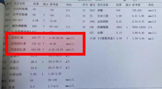 胆红素升高别不当回事！