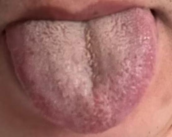 肝经气血瘀滞影响周身供血，疏肝通络巧调养





很多朋友年纪轻轻就出现了见色