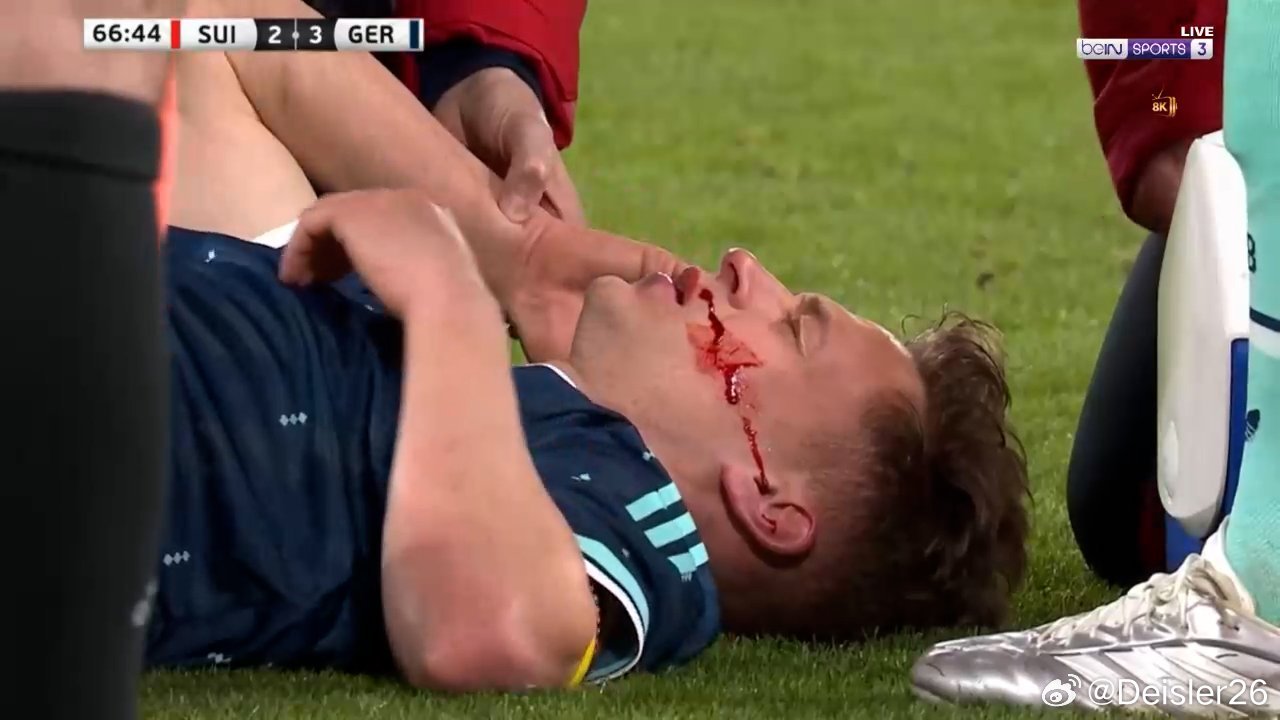 基米希千萬不要有事🙏🏻🙏🏻🙏🏻