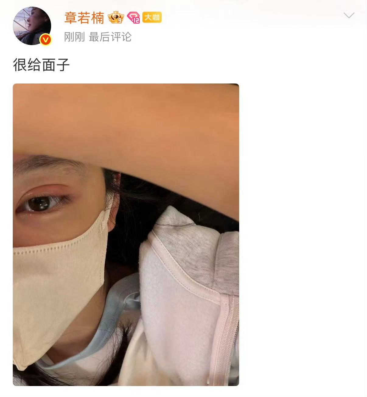 omg，章若楠长麦粒肿了比昨天严重安慰粉丝说没有影响到工作给面子姐姐注意休息呀
