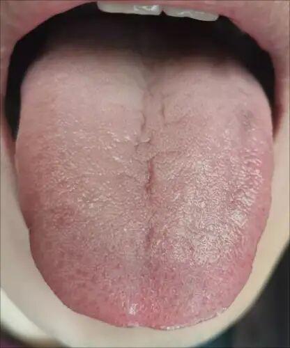 舌象有这个特点的 赶快调肝气 降胃气 胃气一降就舒服了

《黄帝内经》有言：养生