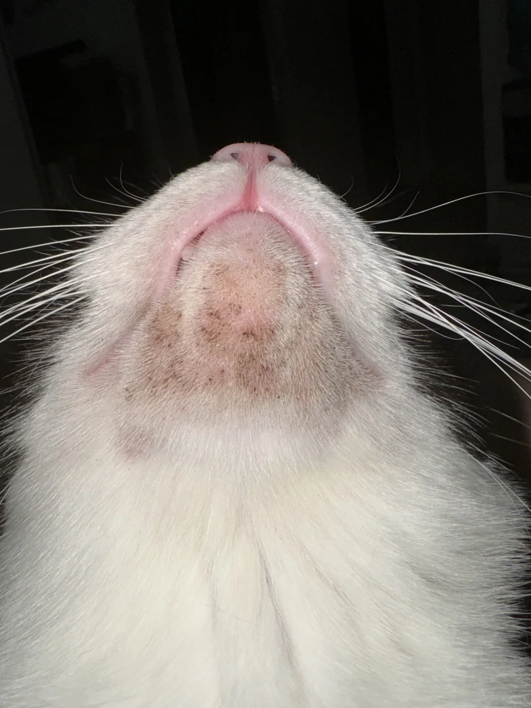 🆘！黑下巴到底怎么才能好！！！