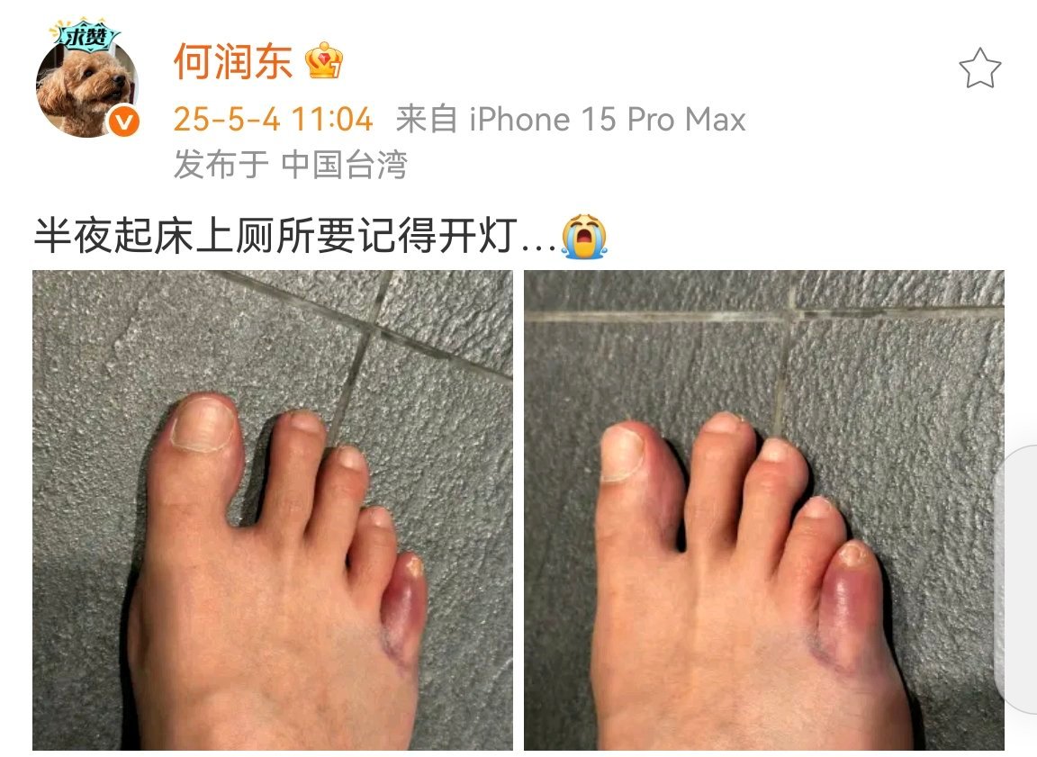何润东半夜不开灯脚趾受伤何润东半夜不开灯脚受伤 心疼何润东[允悲] ​​​