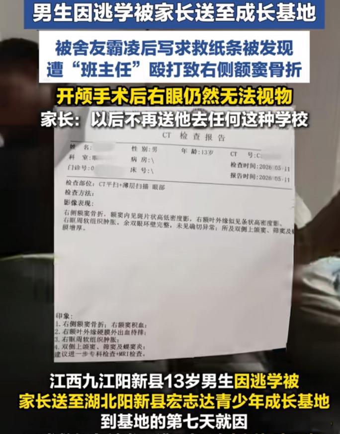 忍无可忍！花 3.28 万送儿子去 “改造”，7 天后竟被打至开颅失明。

为人