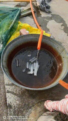 一般来说，结石这么多的话，需要玩命喝水
不过你这个情况似乎又有点特殊……