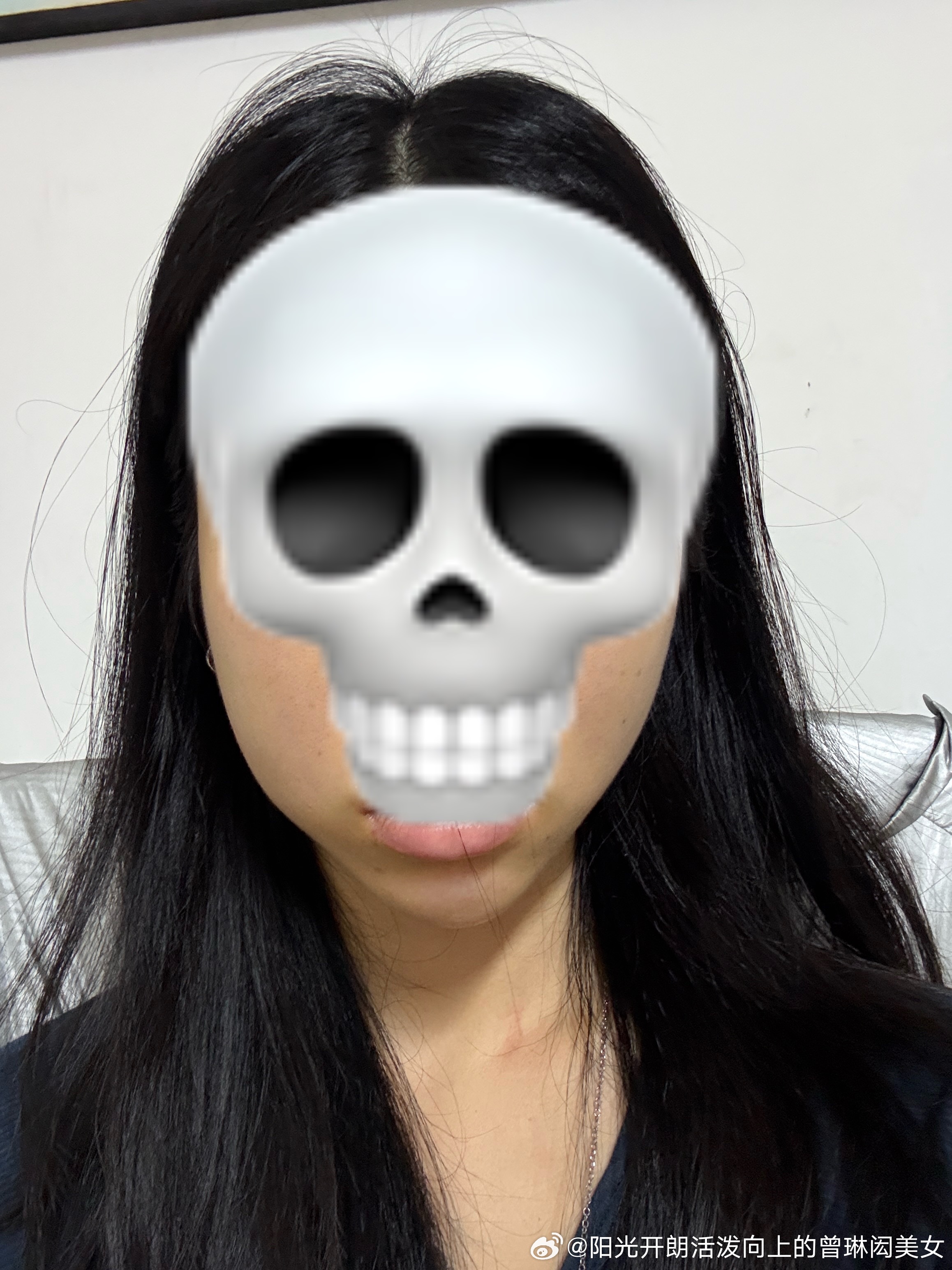 又肿起来了 ​​​