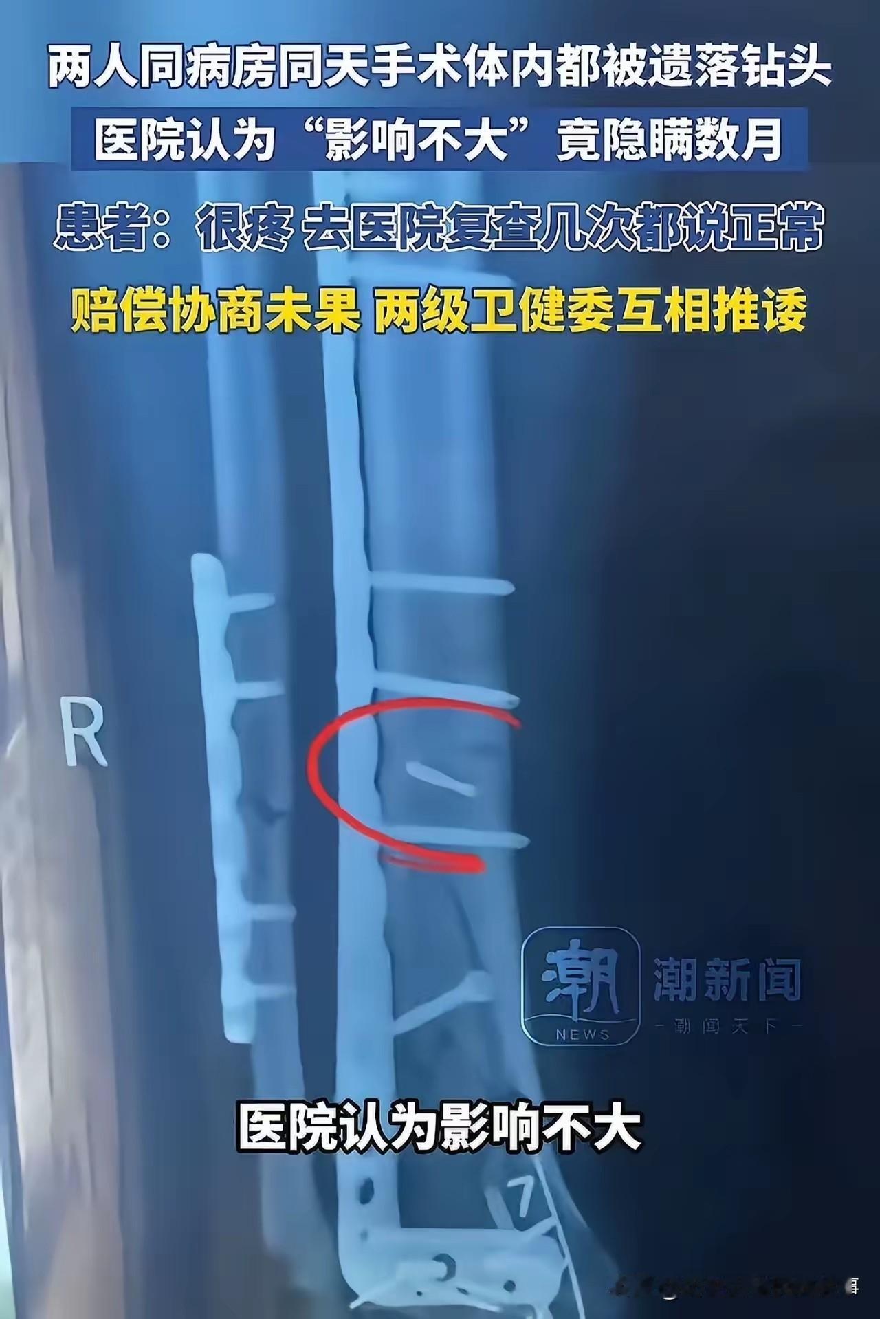 同室同日手术双双遗落钻头！湖南这家医院隐瞒数月，3万罚款引众怒
 
手术室里的医
