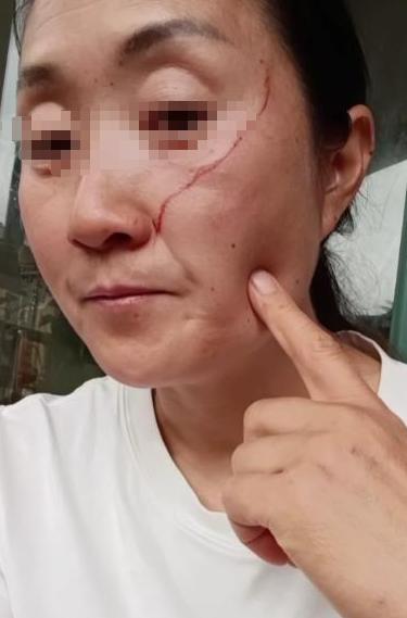 株洲高考母女的母亲，很愚蠢，也不值得同情。
 
都高考结束了，还要女儿保持高考前