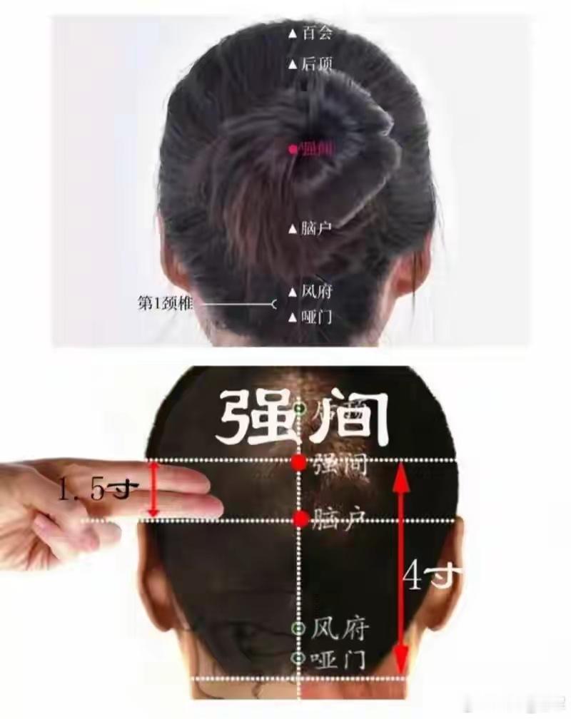 后脑勺强间穴，专治后脑僵紧、顽固失眠、痰浊老头痛强间穴归督脉，别名大羽，在后发际