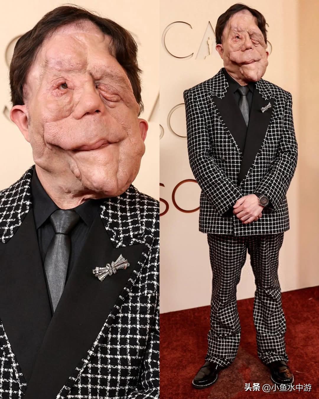 亚当·皮尔森出席2026年奥斯卡颁奖典礼