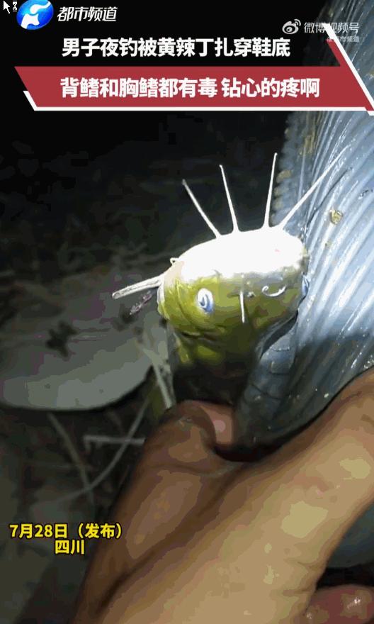 悲剧还是发生了！四川，一名男子在夜钓过程中，突然感到脚底传来一阵无法忍受的剧痛，
